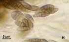 Capronia pulcherrima