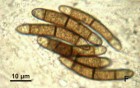 Chaetosphaerella phaeostroma