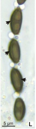 Annulohypoxylon yungensis