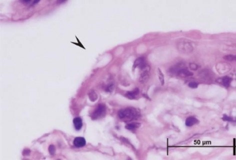 (c) Delgado et al. 2012. Seccion histologica de la epidermis ventral de un especimen adulto de Physalaemus fernandezae de la Reserva Natural Punta Lara, Buenos Aires. La flecha indica un zoosporangio vaci�??�?­o, con tubo de descarga.. 																												First record of Batrachochytrium dendrobatidis in Physalaemus fernandezae (Anura. Leiuperidae) for Buenos Aires Province, Argentina. Herpetological Review, 43 (1): 84-85.																																		